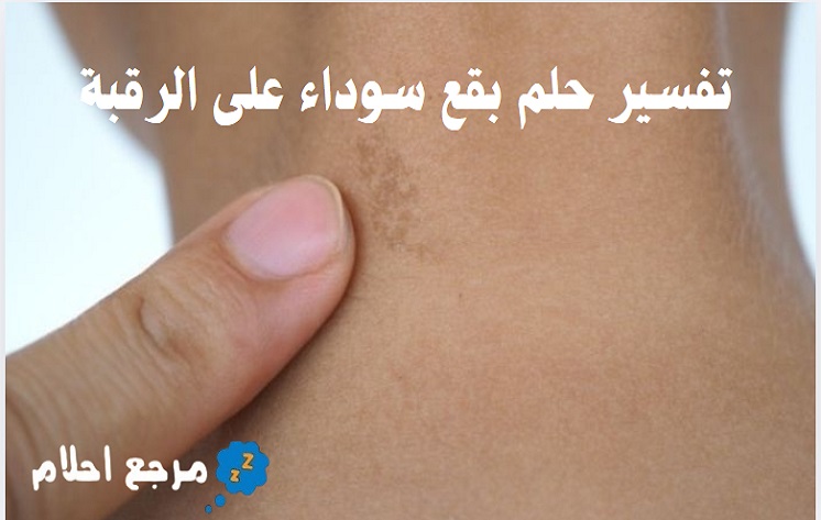 تفسير حلم بقع سوداء على الرقبة في المنام ومدلولاته