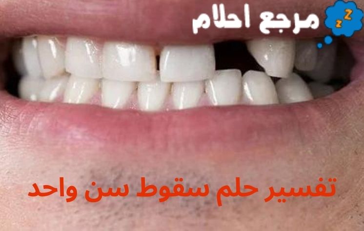 تفسير حلم سقوط سن واحد ينذر بالخير أم الشر؟