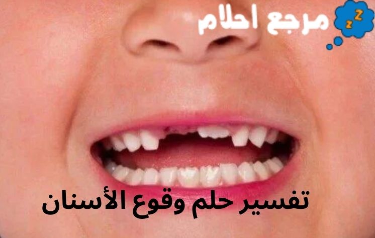 تفسير حلم وقوع الأسنان وعلاقته بطول العمر